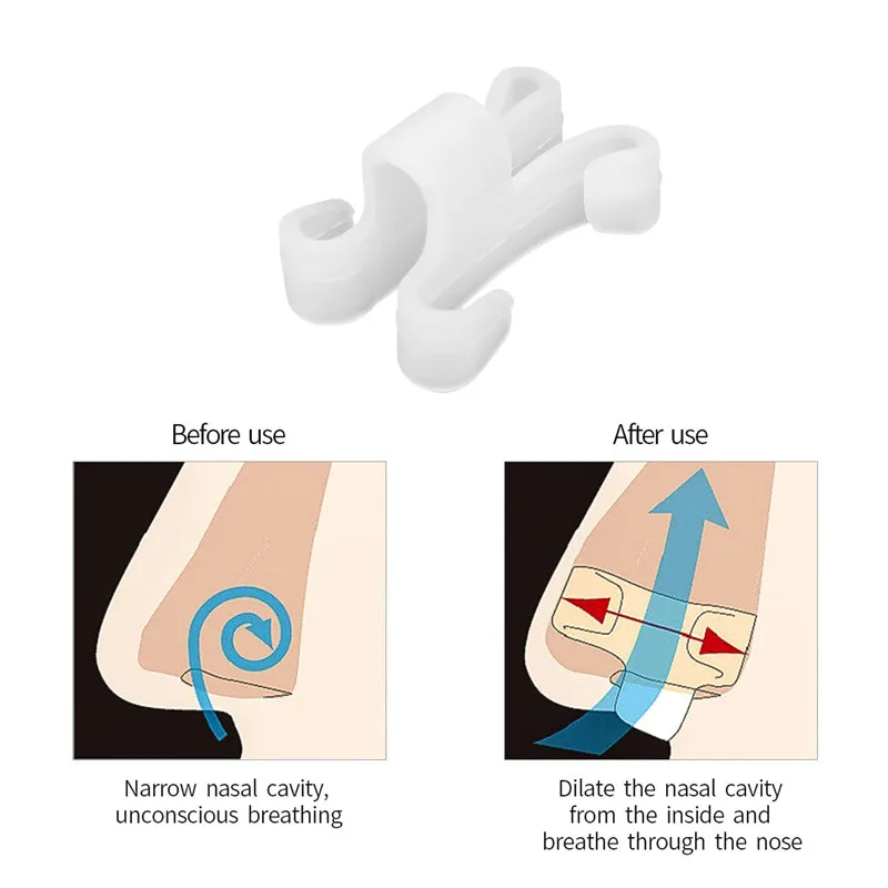 

Mini Anti-Snore Nose Clip Silicone Nasal Dilators Nose Breathing Apparatus Anti Snoring Device Stop Snoring Sleep Aid Guard 31