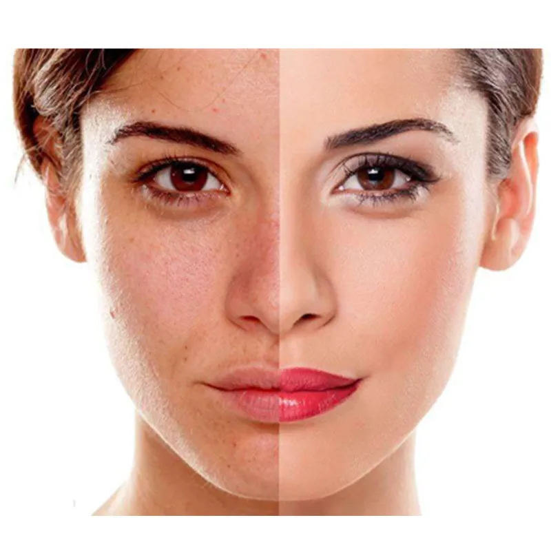 556