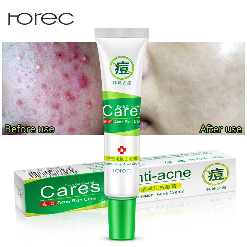 

ROREC Rejuvenation Acne Cream Anti Acne Treatment Scar Removal Gel Whitening Moisturizing Shrink Pores Beauty For Face Skin Care