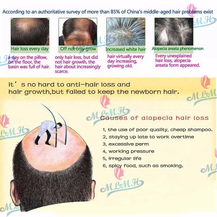 3 шт./лот, натуральная эссенция для роста волос Andrea, против выпадения волос, 10 мл, плотная, унисекс, быстрое восстановление волос, продукты для лечения
