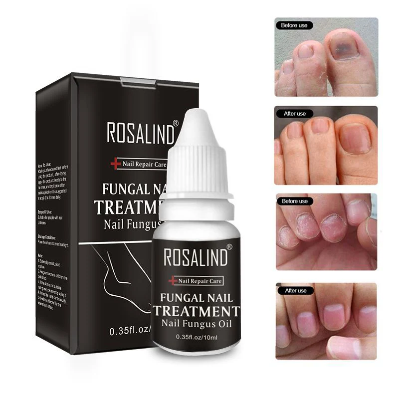 

Mini 10ml Nail Fungus Foot Toe Treatment Repair Essence Oil Removal Dead Skin Nutrient Liquid Hand/Foot Care TSLM2