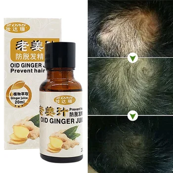 

Ginger juice Hair Loss Products Natural With No Side Effects Grow Hair Faster Regrowth Hair Growth oil Hair & Scalp Treatments 4