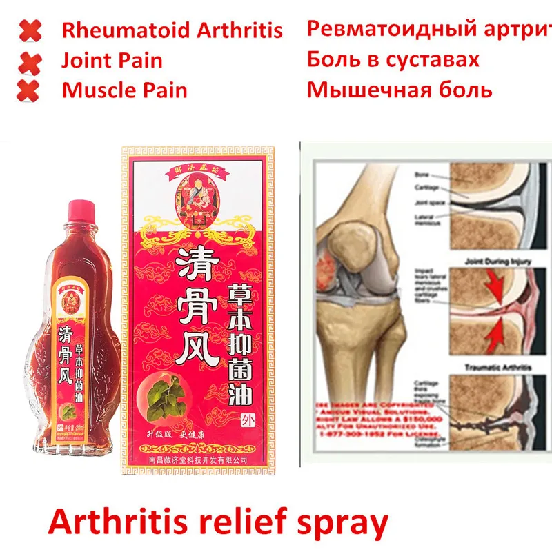 Купить Китайскую Мазь Для Суставов
