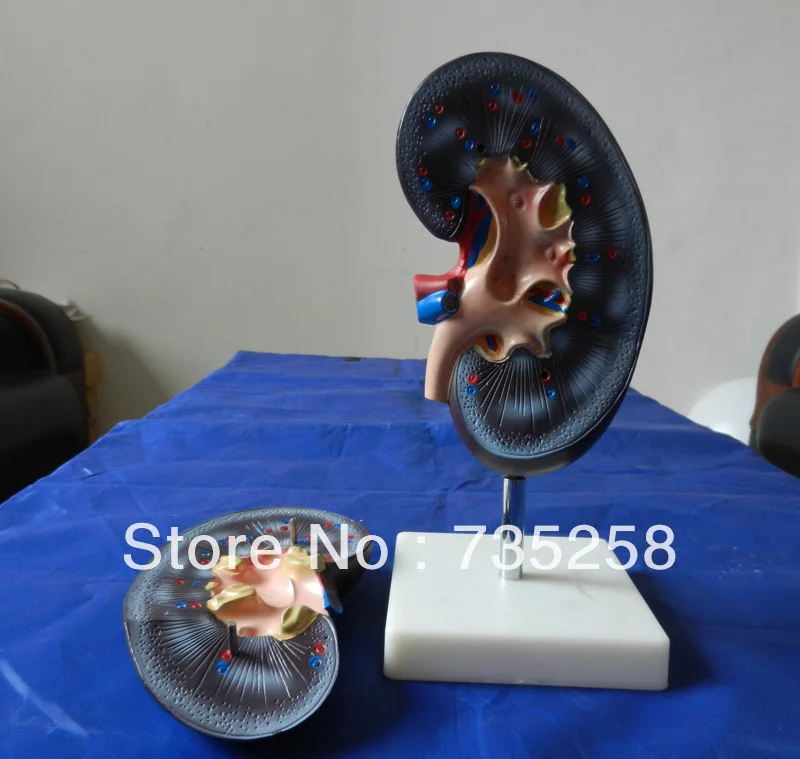 Kidney Model (2 parts),Two Parts Kidney Anatomical Modelin Medical