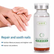 Лечение ногтей отбеливающие ногти Toenai уход восстановление уход эссенция с отверстие бутылки