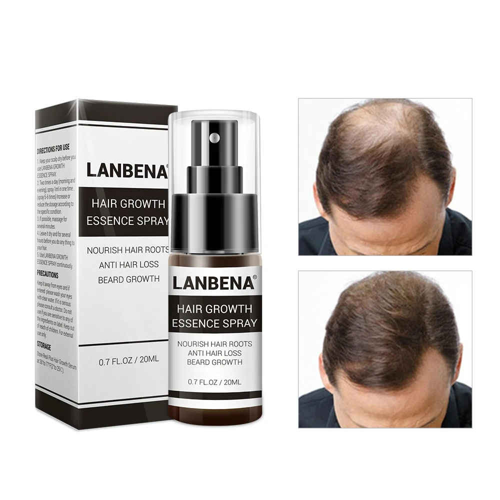 

Hair Growth Essence Spray Product Preventing Baldness Consolidating Anti Hair Loss Nourish Roots Easy To Carry Hair Care Product