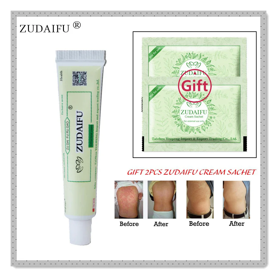 

1piece ZUDAIFU Psoriasis Dermatitis Eczema Pruritus Skin Problems Treatment Cream Chinese Health Herbal Natural Restrain+GIFT