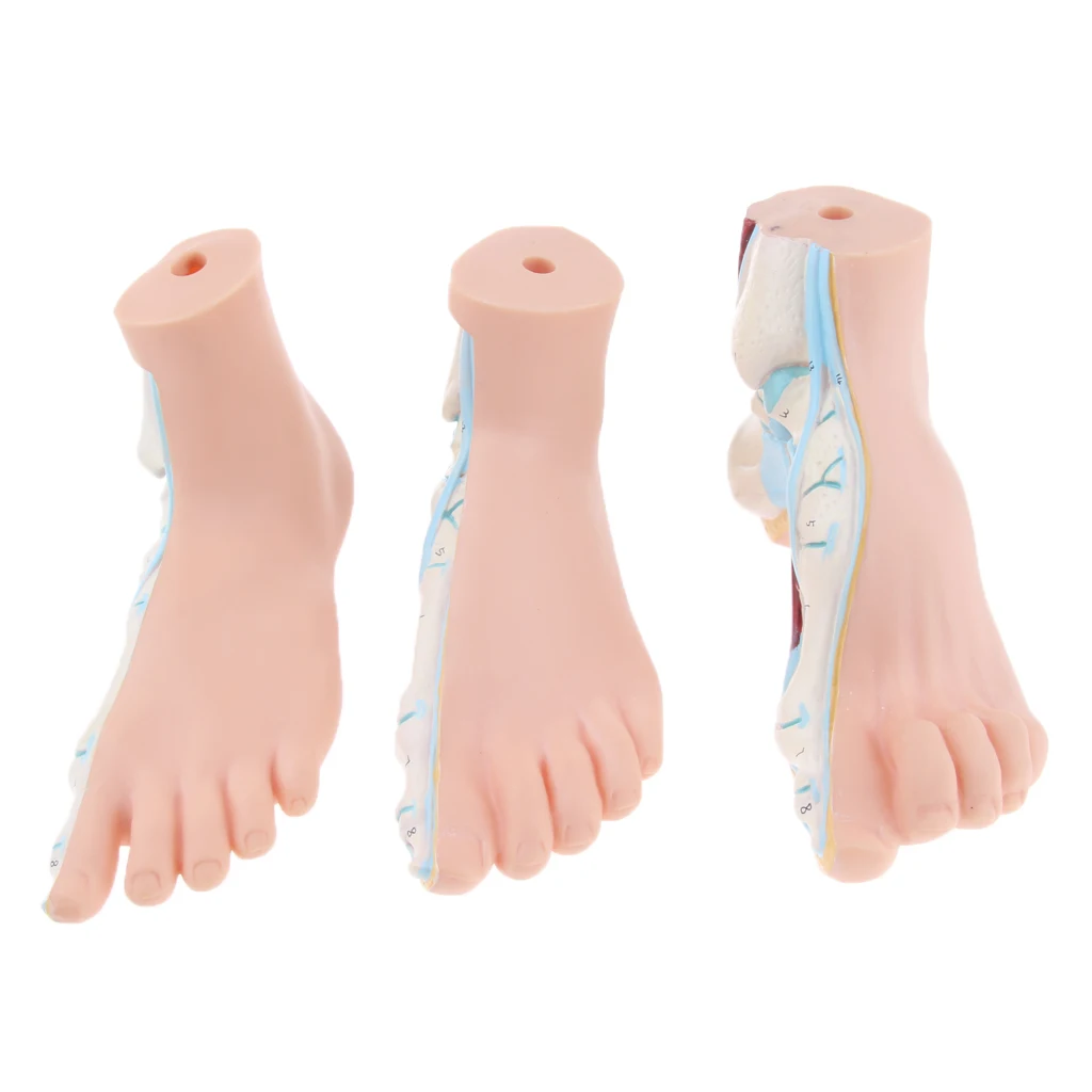 1:1 Life Size Human Foot Platypodia Bow Foot Anatomy Model Muscle Vascular