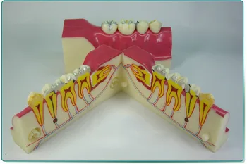 

2X Life Size Free Shipping Model with Inside Bracket Dental Tooth Teeth Dentist Dentistry Anatomical Anatomy Model Odontologia