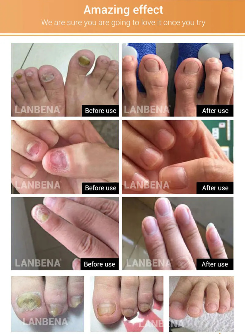 nail-repair-essence-4_02
