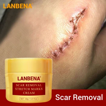 

LANBENA Acne Scar Removal Shrink Pores Gel Bleaching Essence Acne Treatment Cream Whitening Face Cream Skin Care TSLM1