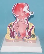 

Human rectum Dissection human organs Anatomy model free shipping
