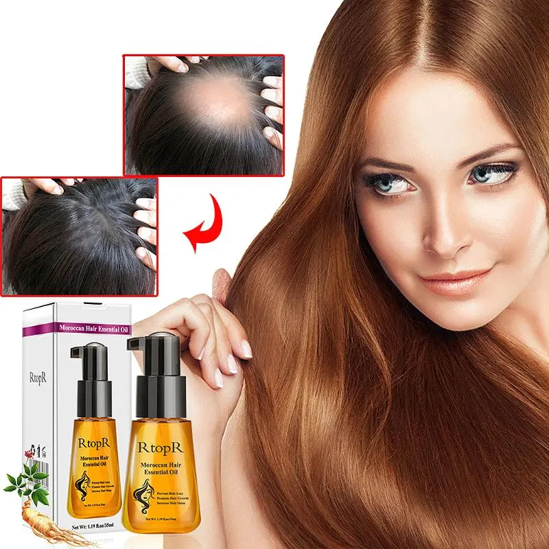 Марокканское масло для волос, чистое эфирное масло для роста, уход за волосами, уход за волосами, предотвращение выпадения волос, 30 мл, для мужчин и женщин