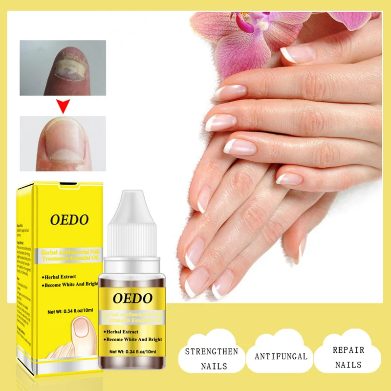 

Ginseng Antibacterial Nail Treatments Essential Oil Nails Fungus Repair Foot Nail Care @ME88