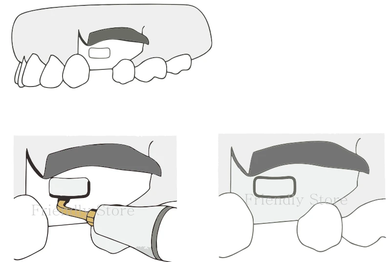 3_