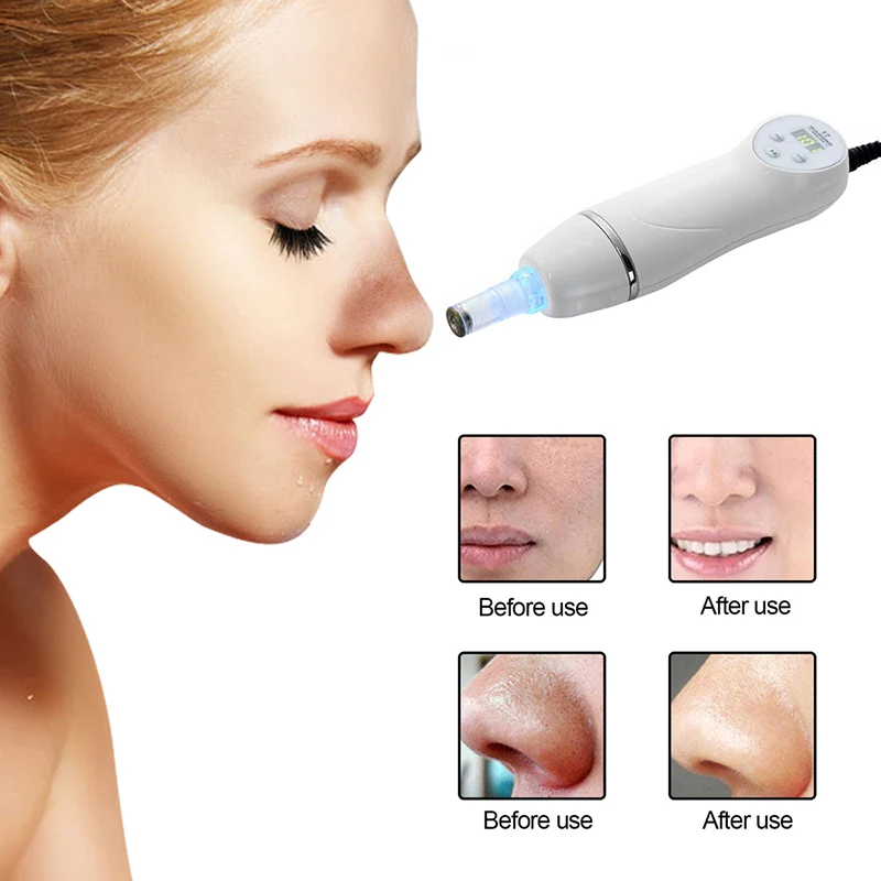 

Pore Vacuum Blackhead Remover Suction Acne Peeling Pore Face Cleanser Facial Skin Care Diamond Microdermabrasion Beauty Machine