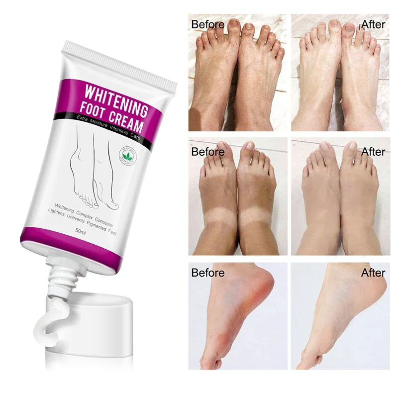 

50ml Heel Crack Repair Cream Anti Crack Whitening Cream Foot Peeling Cracked Hands Feet Dry Skin Moisturizing Care dropship