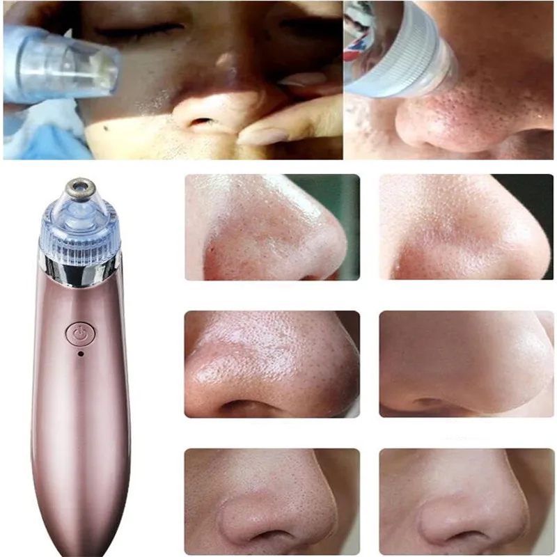 Electric Vacuum Suction Facial Pore Cleaner Nose Blackhead Comedo Remover Face Cleansing Pustule Acne Cleaning Removal Skin Care