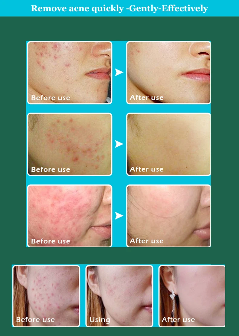 HTB1R6XlPVXXXXXTXXXXq6xXFXXXY