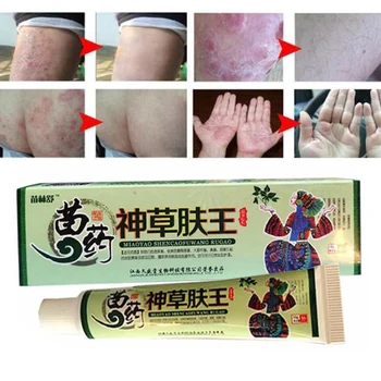 

100% Natural Herbal Creams Body Psoriasis Cream Perfect For Dermatitis and Eczema Pruritus Psoriasis Skin Problem Plaster D191