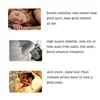Acupressure Anti Snore Ring Treatment Reflexology Anti Snoring Apnea Sleeping Device SN-Hot 6