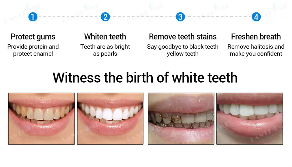 Отбеливатель 3D белые зубы, отбеливание зубов ручка гель отбеливатель удалить пятна гигиены полости рта мгновенная улыбка Pro Nano отбеливание зубов комплект