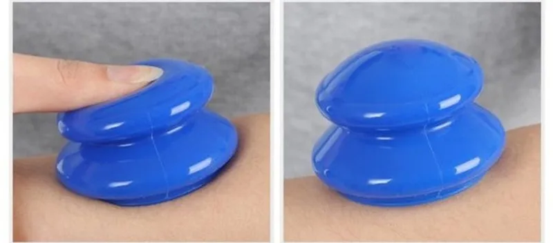 Cupping 9