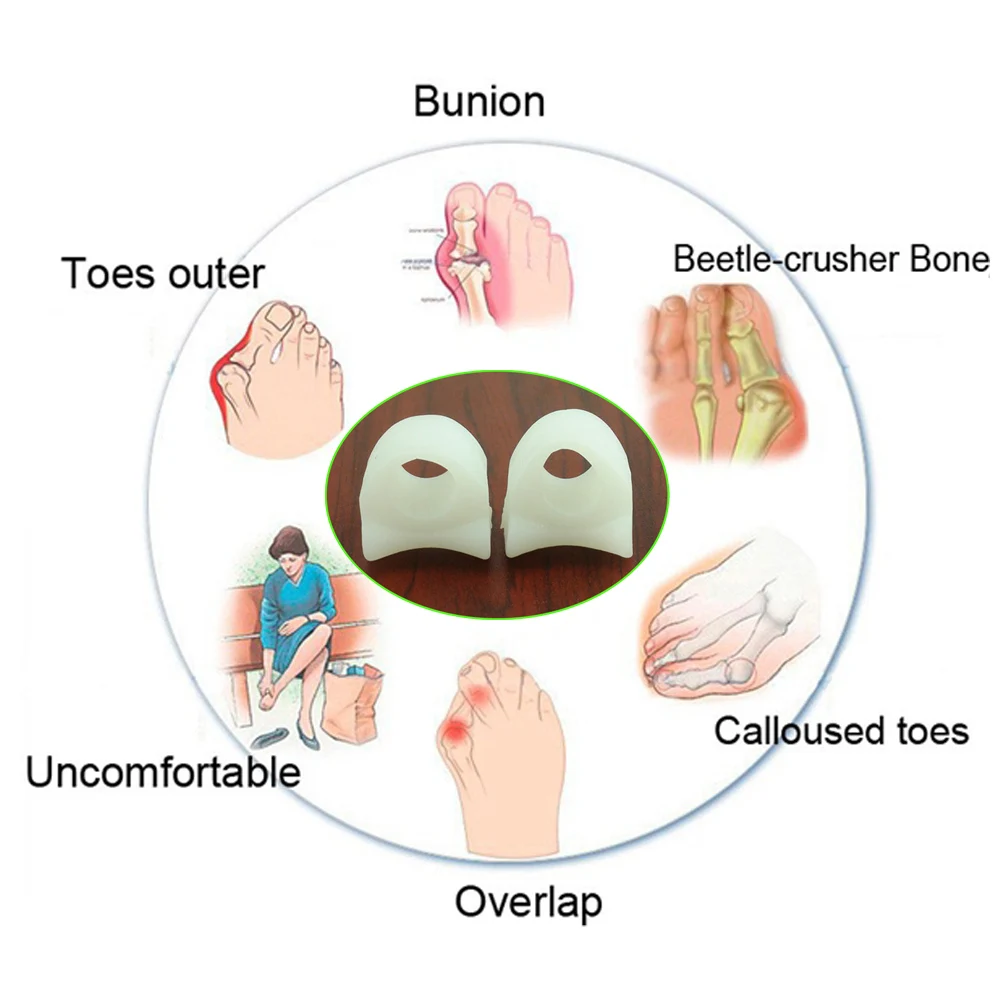 6 шт., корректирующие накладки обеспечивают бюнион облегчение, предотвращают Потертость пальцев ног силиконовый разделитель для пальцев ног без петли для бюнионов и мозолей D0303
