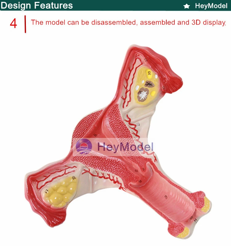 4 _