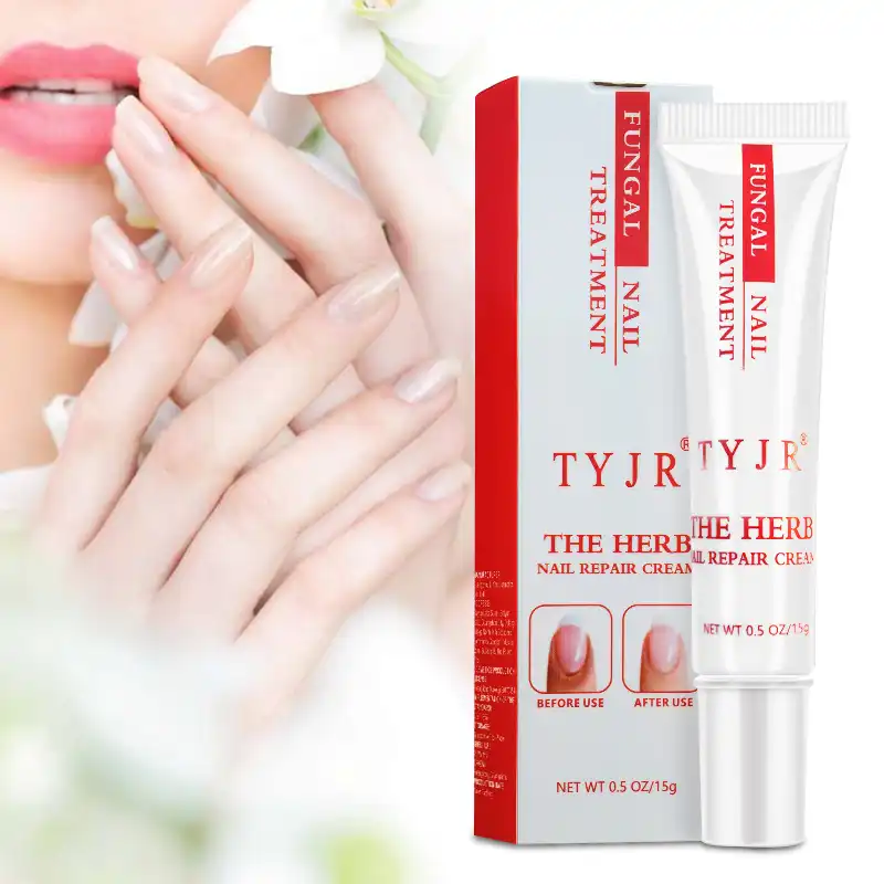 Bacterial Nail Infection Treatment best fungus nail treatment cream onychomycosis paronychia anti fungal nail infection fights bacteria and fungus naturally