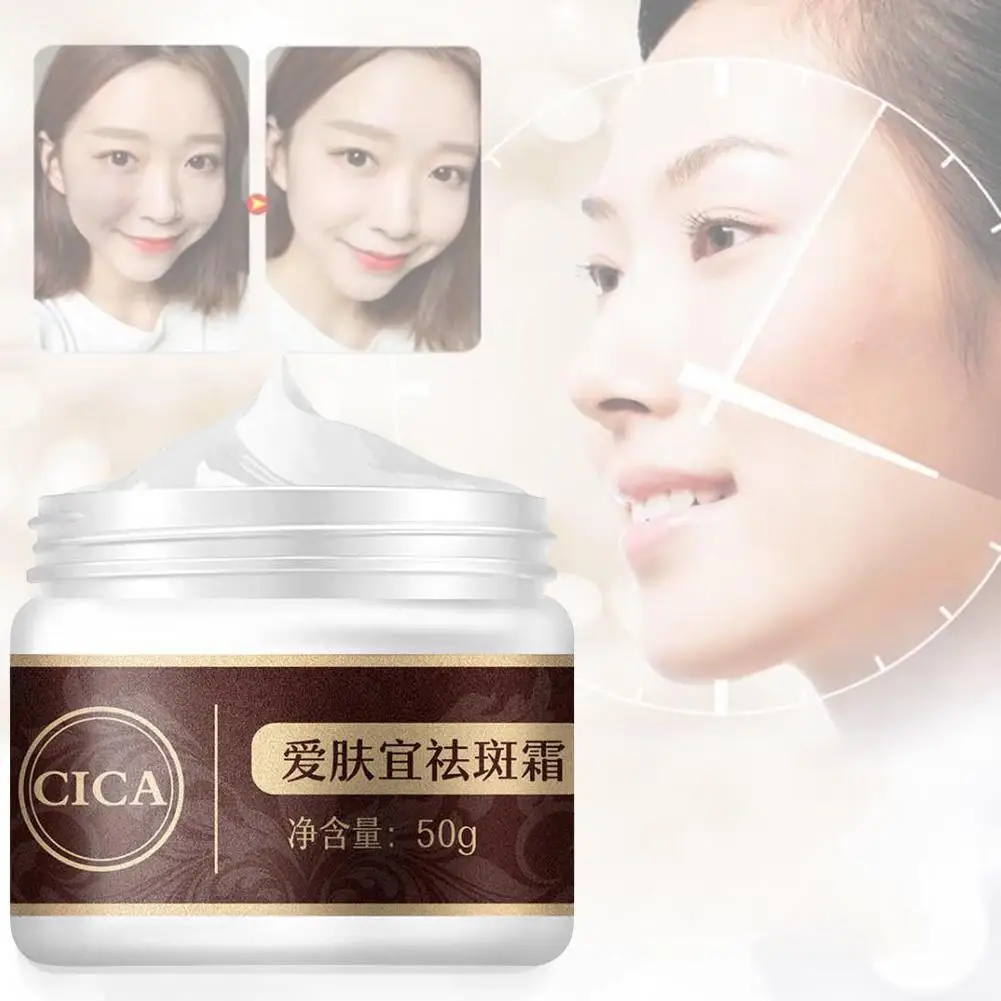 Strong Effects Powerful Whitening Freckle Cream 40g Remove Melasma Acne Spots Pigment Melanin Whitening Moisturizing Skin Care