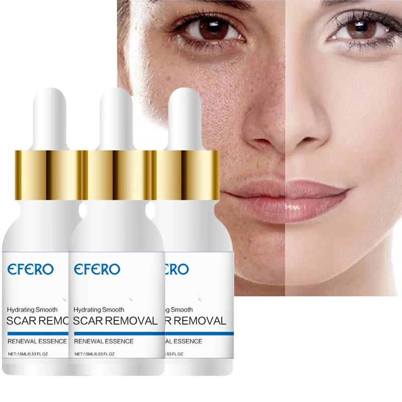 

EFERO Moisturizer Face Serum Shrink Pores Anti Age Anti Wrinkle Serum Acne Treatment Moisturizer Essence Face Whitening Cream