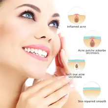 360/180/36 шт. Патчи от акне, прыщей, лечение акне, прыщей мастер патч, прыщей, лечение акне наклейки Красота Инструменты для ухода за кожей