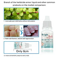 2 шт. противогрибковые средства для лечения дополнительной прочности грибка для ног для спортсменов, грибки для ногтей TY99