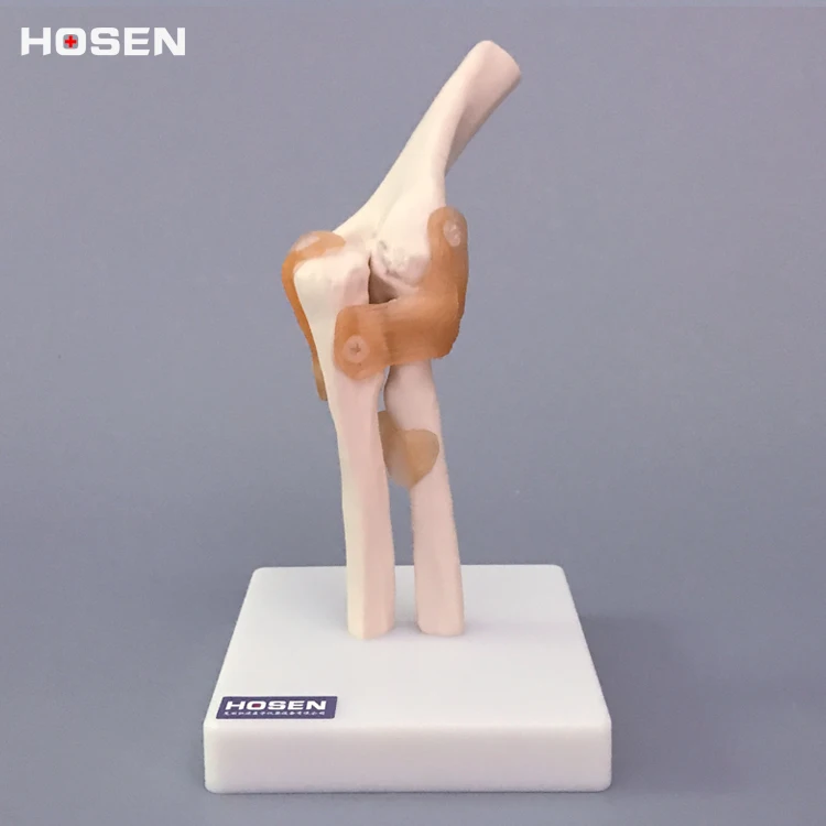 

Model of bone ligament structure of radial bone in elbow joint model