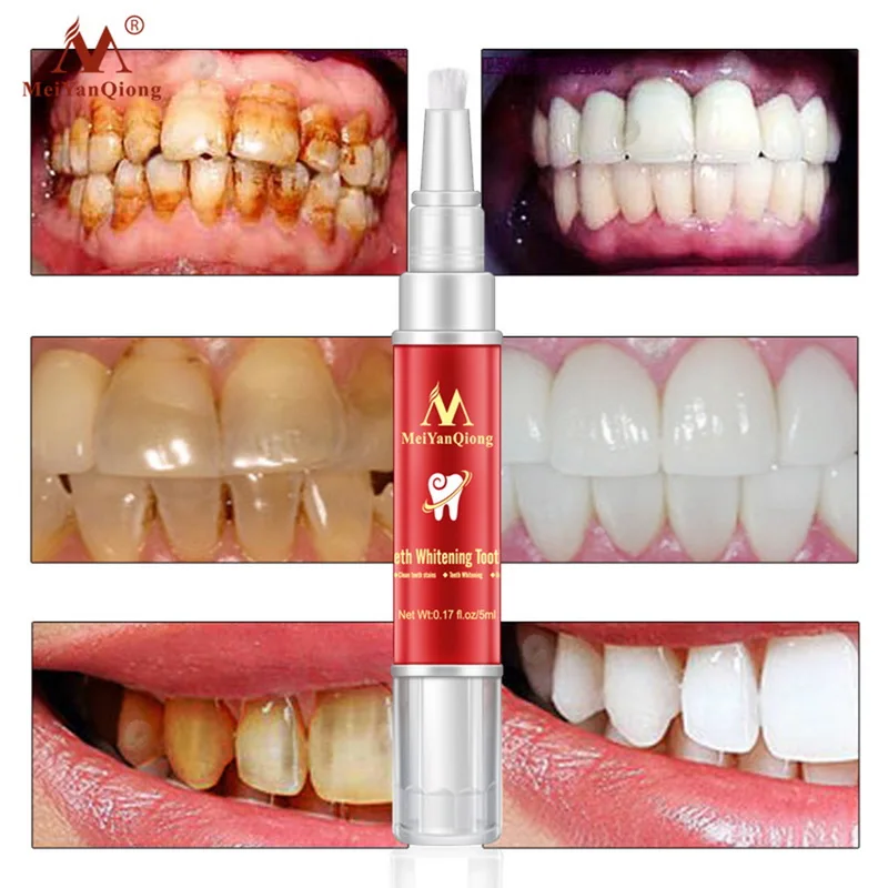 

MeiYanQiong Tooth Brush pen Teeth Whitening Dental Tool Remove Tooth Eraser Natural Tooth Bleaching Smile Teeth Care new hot