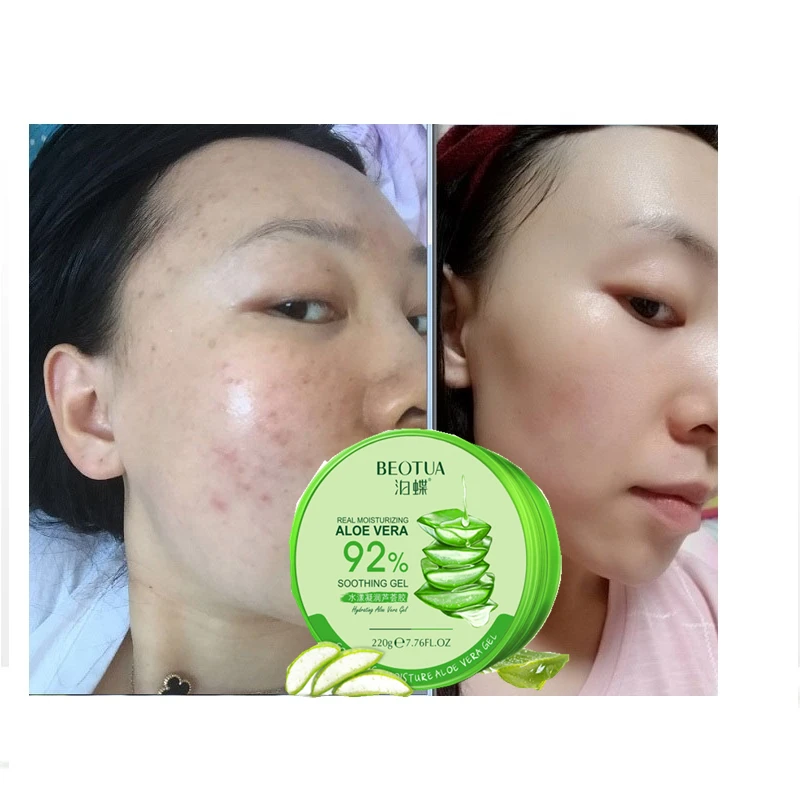 HOT Hydrogel Aloe Vera Gel Moisturizing Whitening Moisturizing