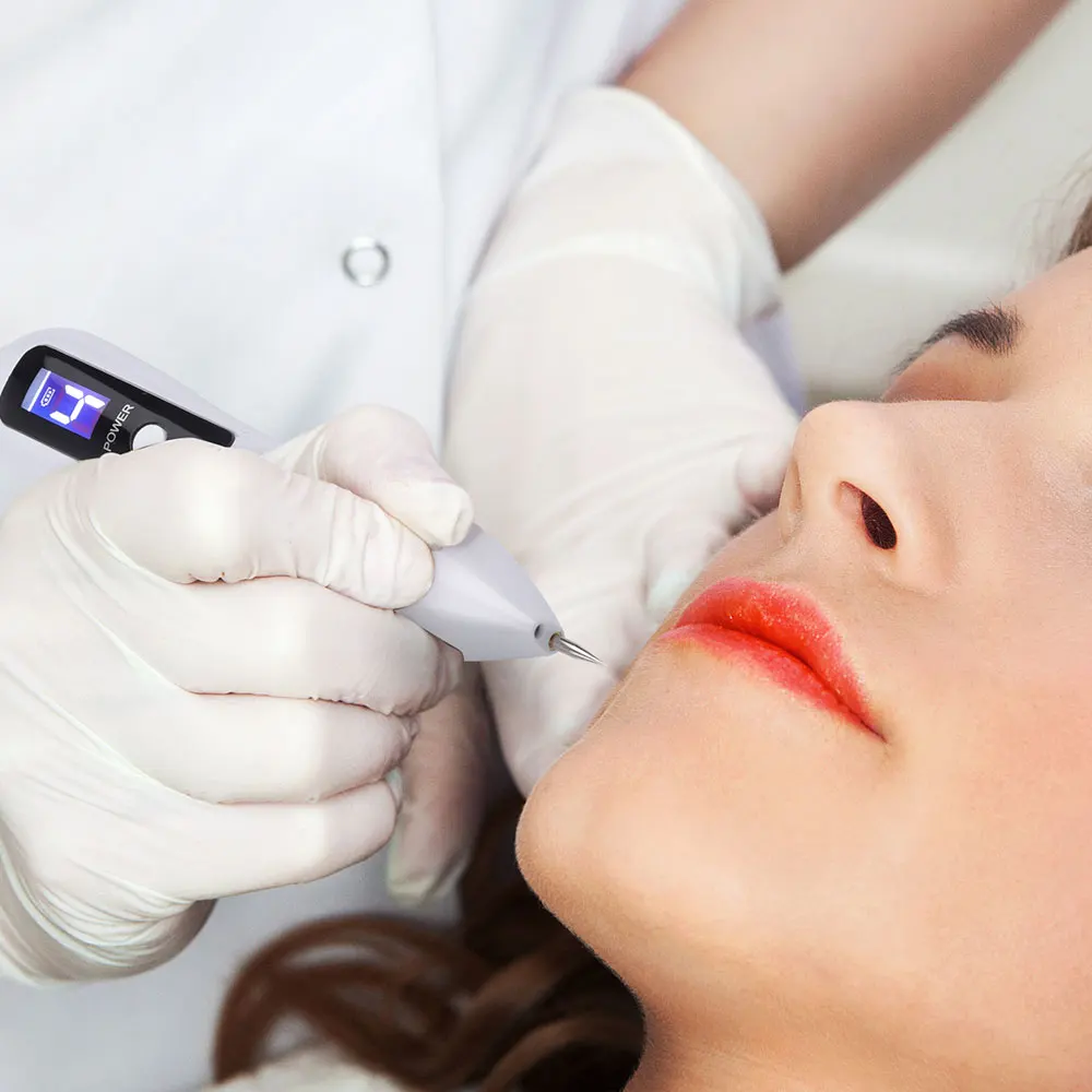 Removedor de Manchas Cuidados com a Pele Verruga da Pele Ferramenta de Remoção da Tatuagem Cuidados com a Beleza Mais Novo Laser Plasma Caneta Mole Remoção Escuras Lcd Ponto Tag Mod. 1263234 16 Beleza e saúde
