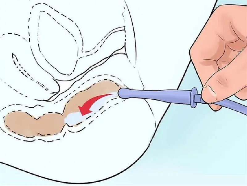 Wetips силиконовый анус клизмы мягкая чистка биде Pera Анальный Душ переносной шланг анус душ клизмы душ анальный гриф биде