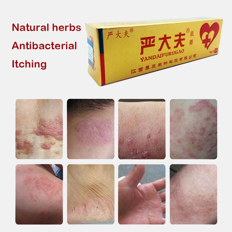 

Body Psoriasis Ointment Herbal Cream Dermatitis Eczema Pruritus Cream Hot Psoriasis Cream Treatment Skin Care Cream 15g