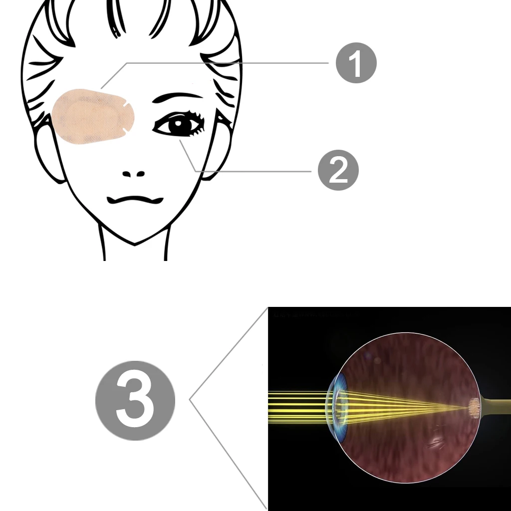 20 шт. амблиопия глаз патчи ребенок амблиопия обучение ортоптическое исправлены тени для век детей окклюзии медицинские ленивый глаз патч мягкий