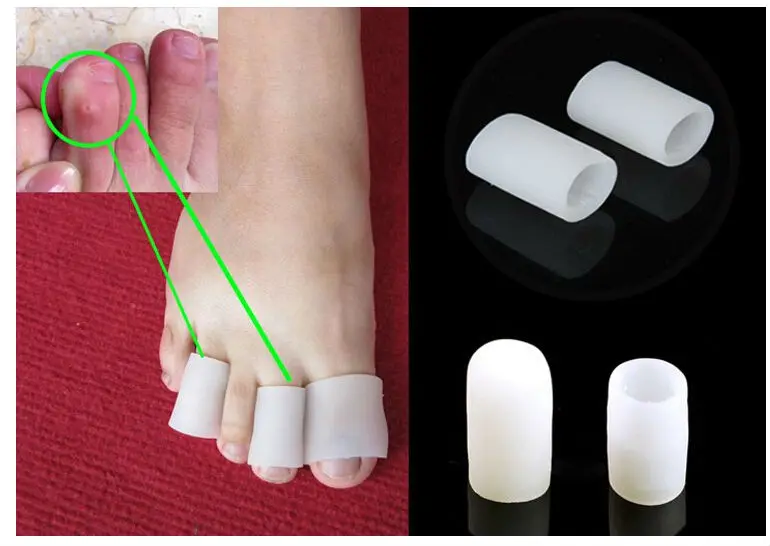 10 штук для ухода за ногами, силиконовые гель тупиковая труба пальцы мозолей носок разделитель для ноги средство для удаления костных облегчение боли
