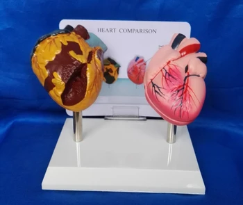 

1:1 LifeSize Human Smoking Heart Vs Normal Heart Comparison Model Heart Anatomy Model Human Heart Anatomy Medical Teaching Model