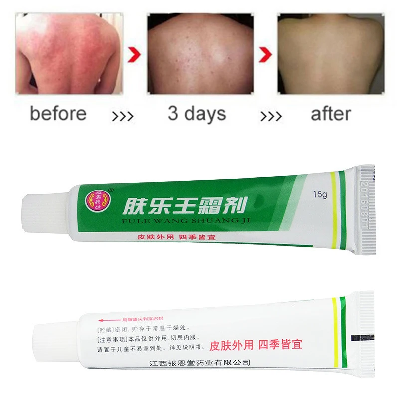 

3 PCS Hot Selling Fule Wang Psoriasis Cream Eczema Ointment Psoriasis Creams Without Retail Box