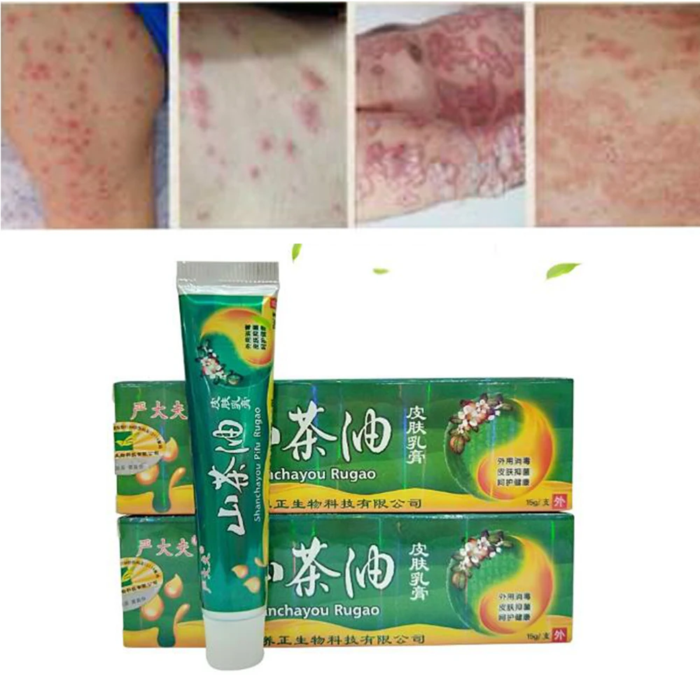 

15g Natural Chinese Medicine Herbal Mint Cream Psoriasis Eczema Ointment Treatment High Quality Herbal Cream For All Skin D157
