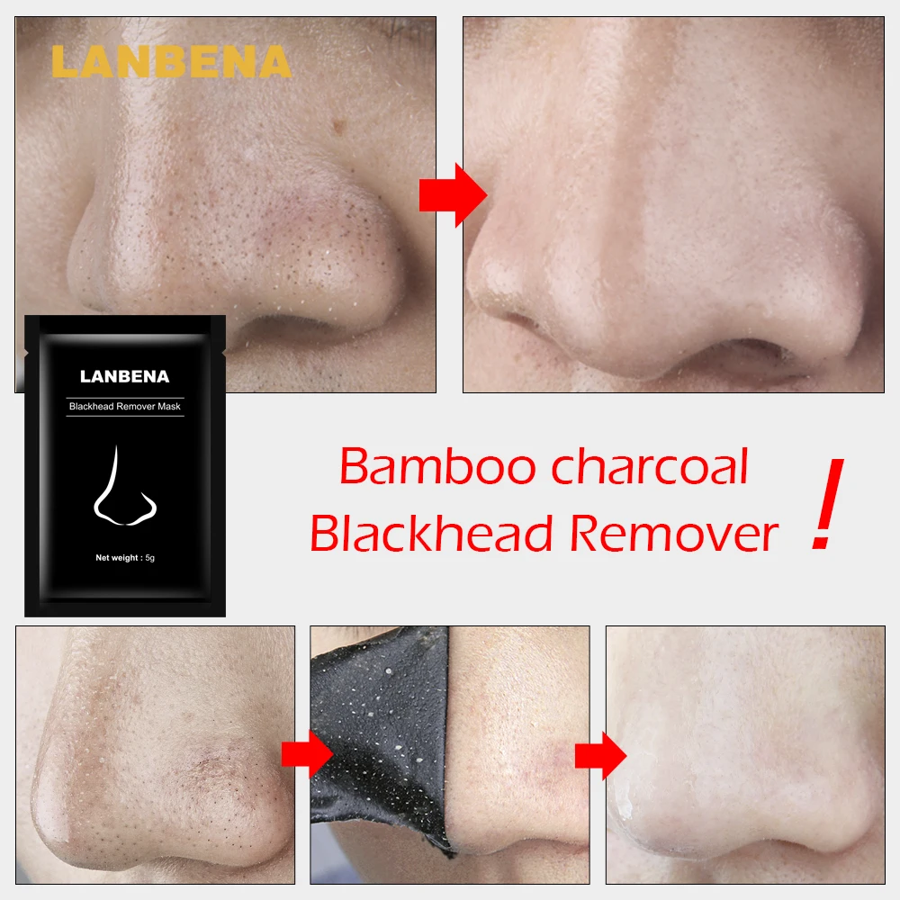

LANBENA Blackhead Remover Nose Masks Face Mask Acne Treatment Peeling Black Mask Pore Strip Black Head Peel Mask Skin Care 10PCS