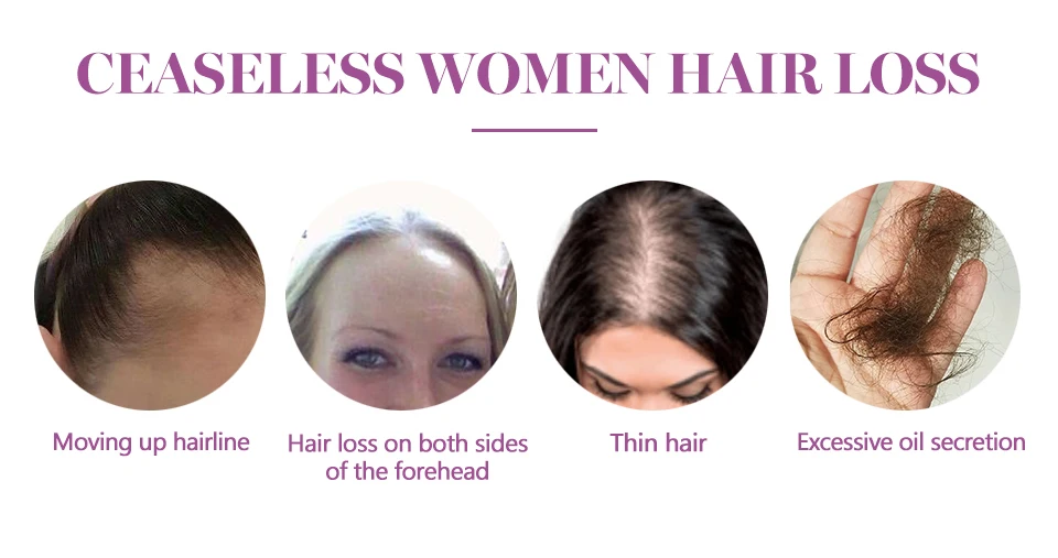 Масло для лечения роста волос против выпадения волос эссенция быстро густые волосы брови поддержка естественных здоровых волос лечение для женщин