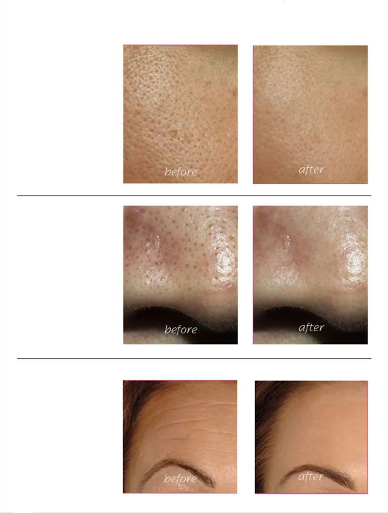 skin crubber (1)