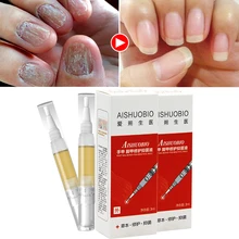 Ручка для лечения Ногтей onychomicosis Paronychia против грибковой инфекции ногтей, Лечение грибка ногтей P1