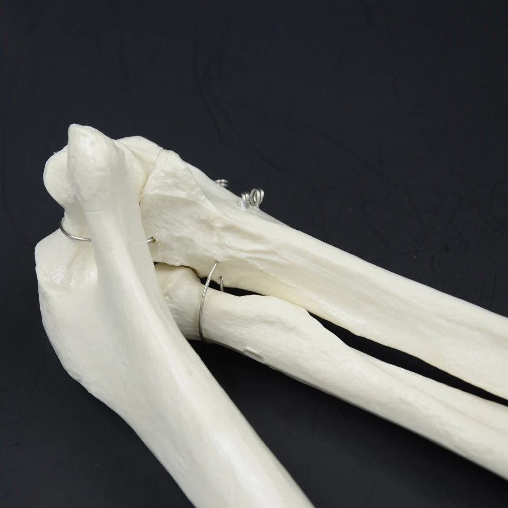 HTB1bcBsOVXXXXbzapXXq6xXFXXX0